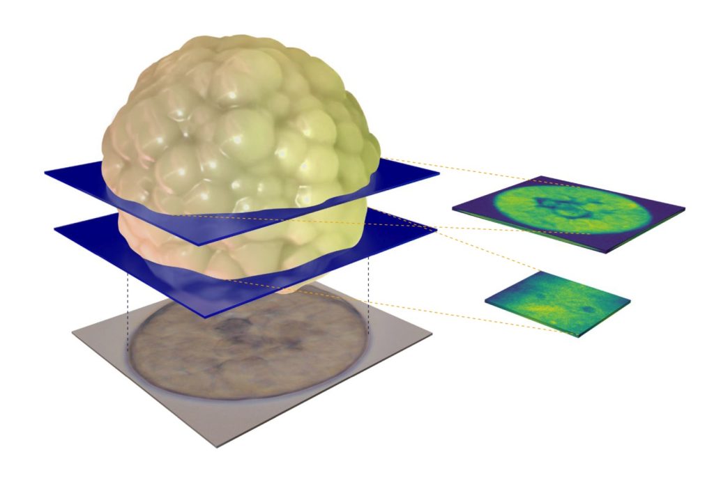 Graphic depicting a three-dimensional organoid with sections in brightfield and fluorescence microscopy.