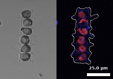 Wiegand et al, 2025. S-BIAD2258