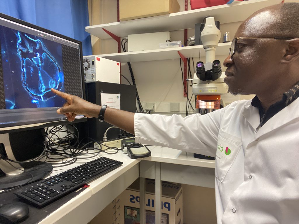 Brice Tonfack in front of the autofluorescence.
