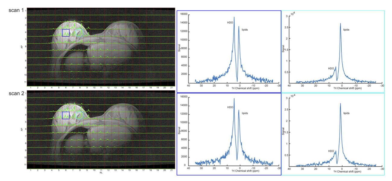 Axial slice of two natural abundant 2H MRSI scans acquired after each other of a healthy volunteer (2H receiver loop beneath the right breast). Selected voxels (indicated in blue and red) containing different ratios of glandular breast tissue and fat shows peaks from HDO, set to 4.7 ppm and a lipid signal at 1.0-1.3 ppm. Almost similar signal intensities of both 2H MRSI scans (submitted to ISMRM).