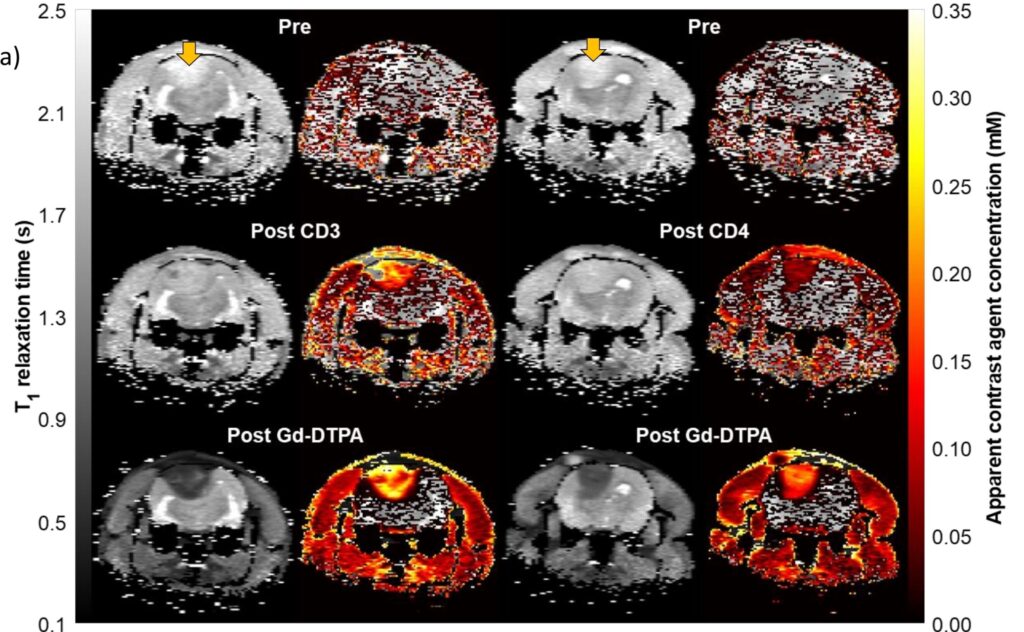 T1 maps measured in rats bearing C6 brain tumor