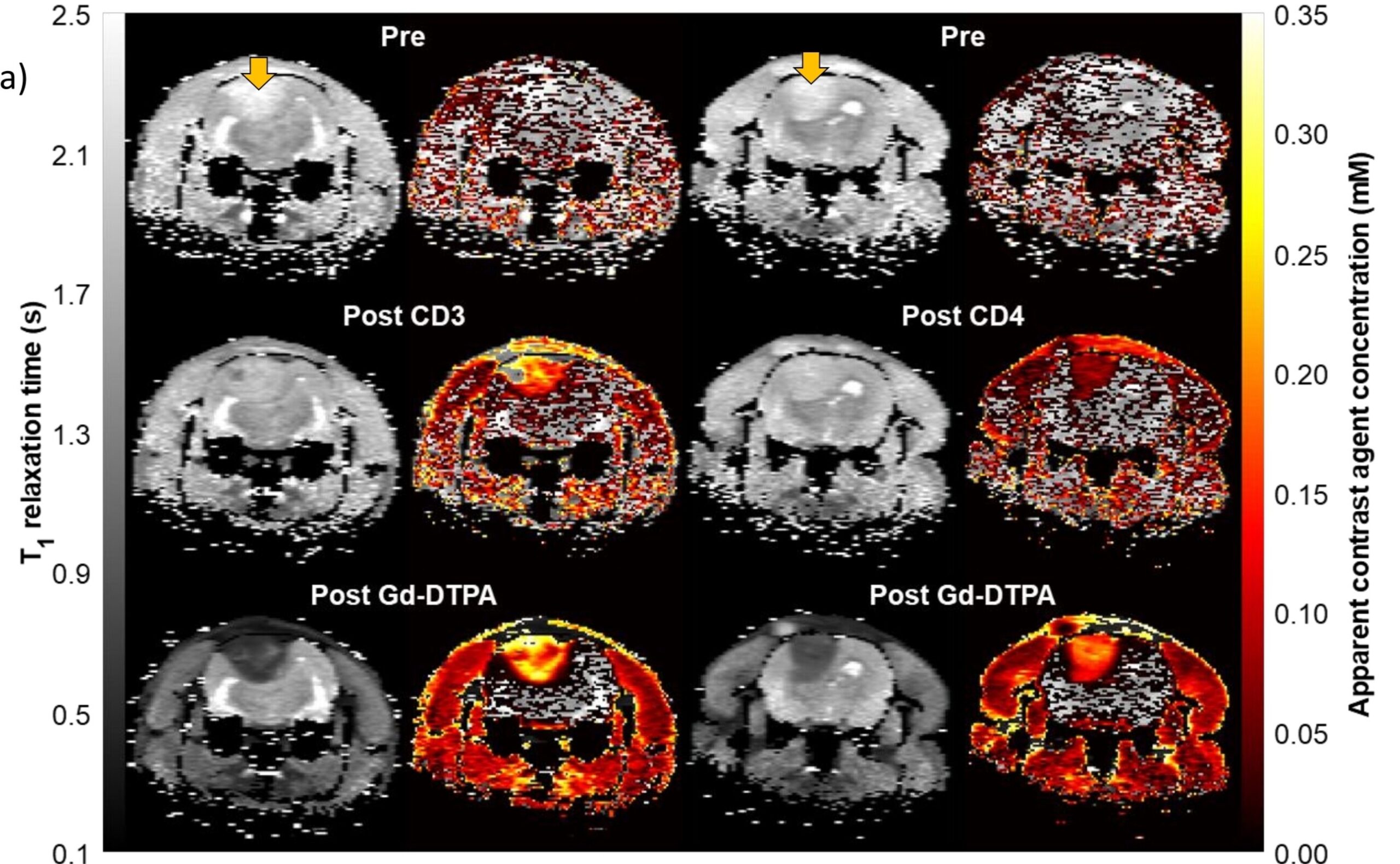 T1 maps measured in rats bearing C6 brain tumor