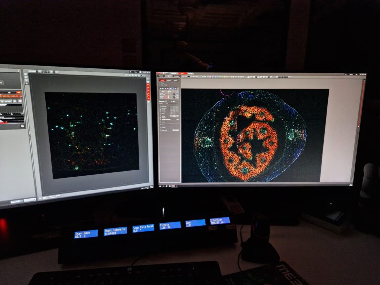 Photo of computer screens with images from microscopy.