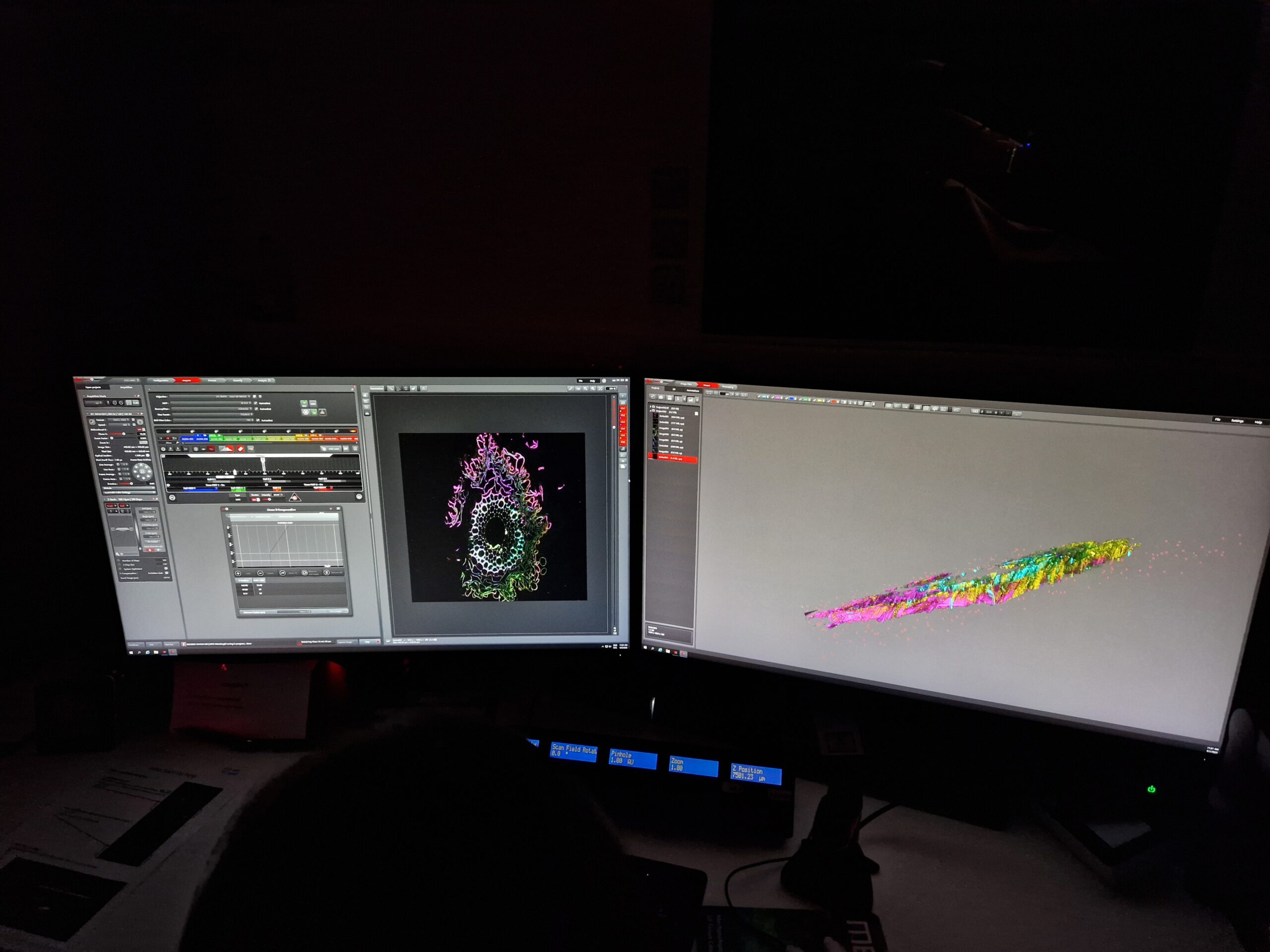 Photo of two computer screens with microscopy images displayed on them.