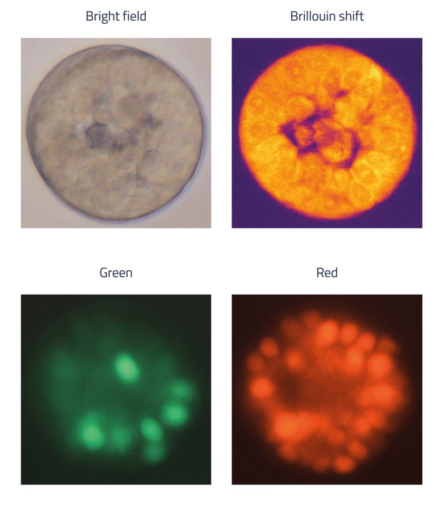 Sections of an organoid with brightfiled, Brillouin, green and red fluorescence.