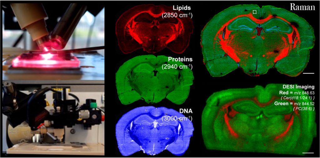 Raman/ DESI-MS image of Murine brains