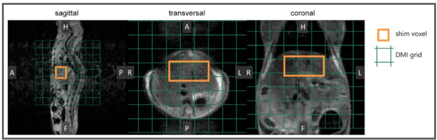 In vivo anatomical 3D MR images