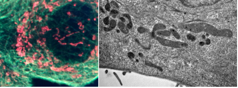 Illustrative images of mitochondria in SKBR3 cells treated with AsLOV2-DARPin(HER2). Images were obtained by confocal microscopy in 3D mode (left) and by electron microscopy (right).