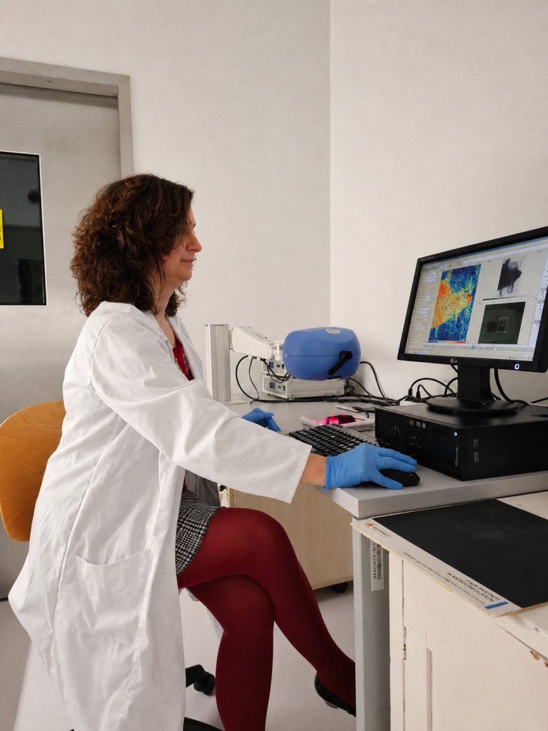 A woman in front of a Laser Speckle Contrast Imaging system.
