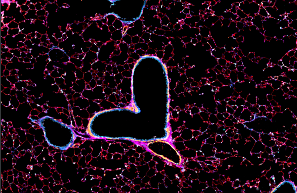 Image of cancer tumour environment.