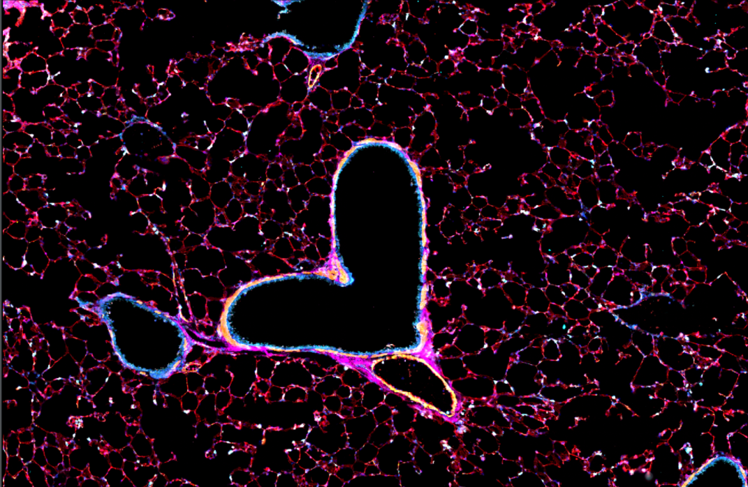 Image of cancer tumour environment.