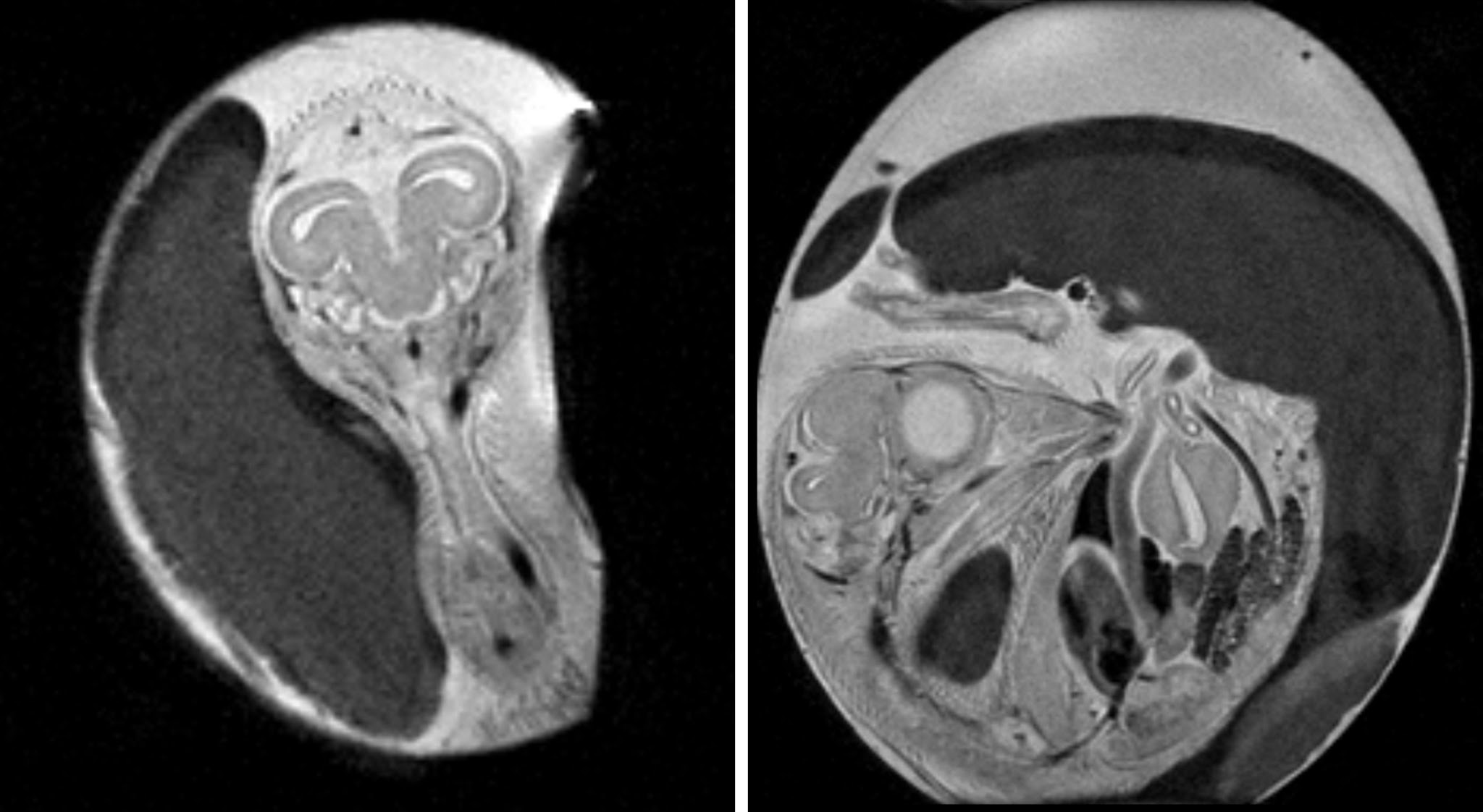 Chicken embryos as seen by MRI.