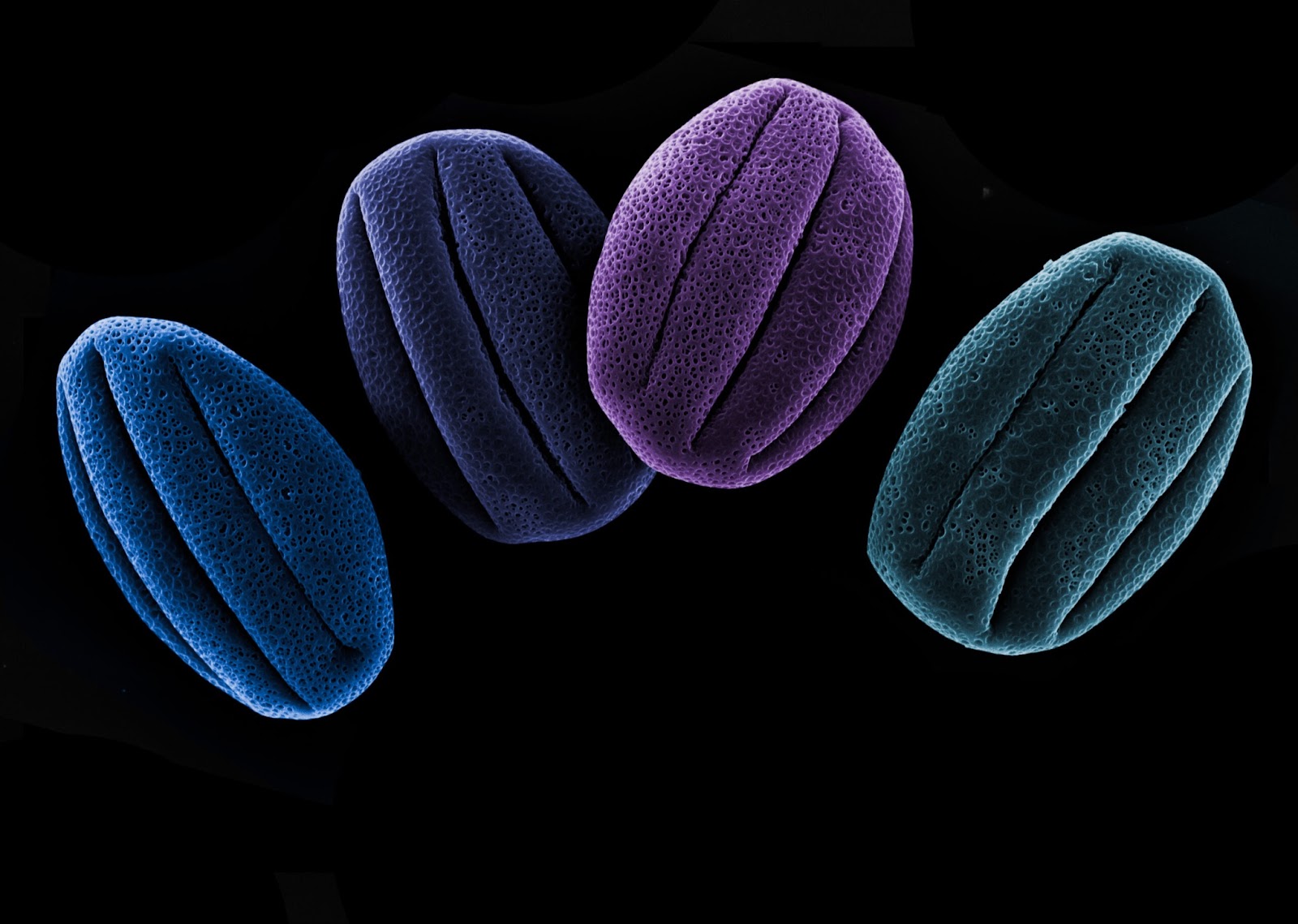Four Shades of Pollen Allergy, by Tomáš Figura, Faculty of Science, Charles University, Prague, Czechia
