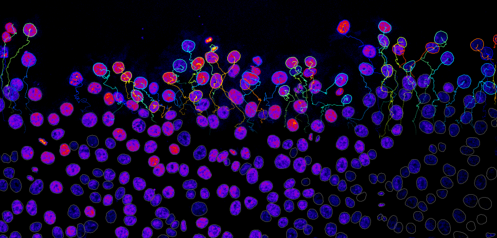 Nuclei tracking. Image credit: G. Jacquemet (Cell Migration lab, Åbo Akademi University), J.-Y. Tinevez (IAH).