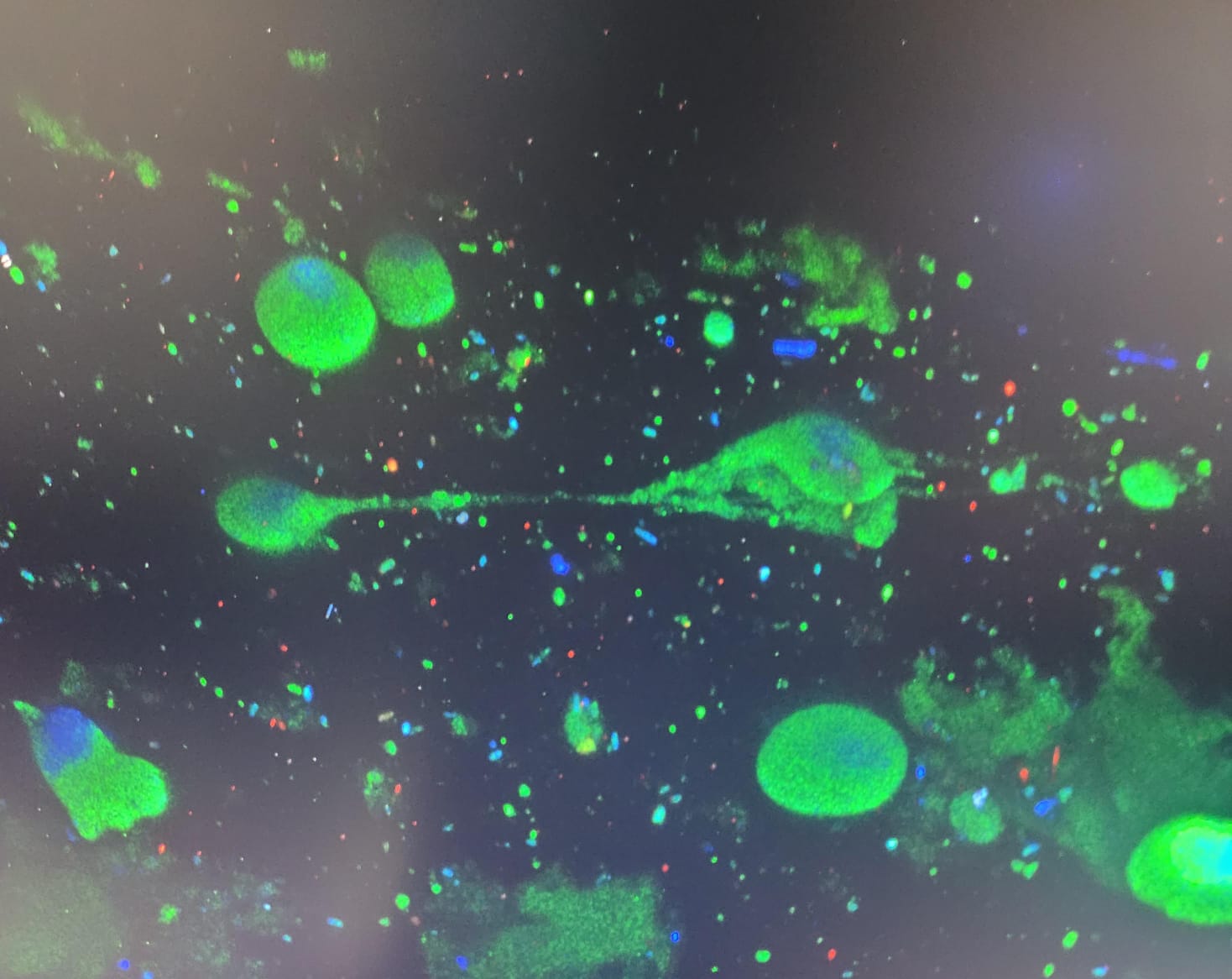 Looking at the neuronal cells in the hydrogel with two-photon microscopy.