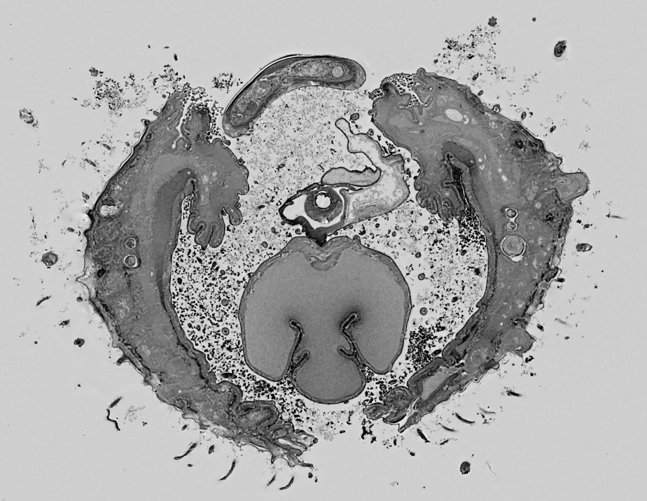 Transversal section of the tip of the proboscis of the tiger mosquito Aedes albopictus acquired by array tomography.
