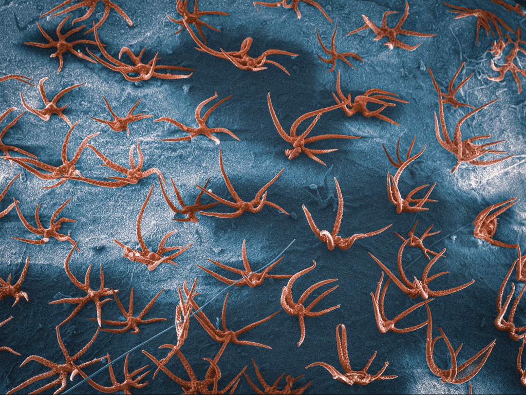 Seed surface of Alyssum alyssoides by Tomáš Figura