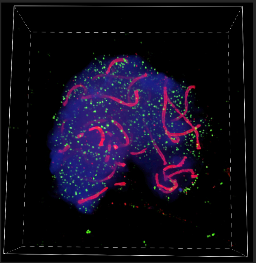image from spinning disk microscopy
