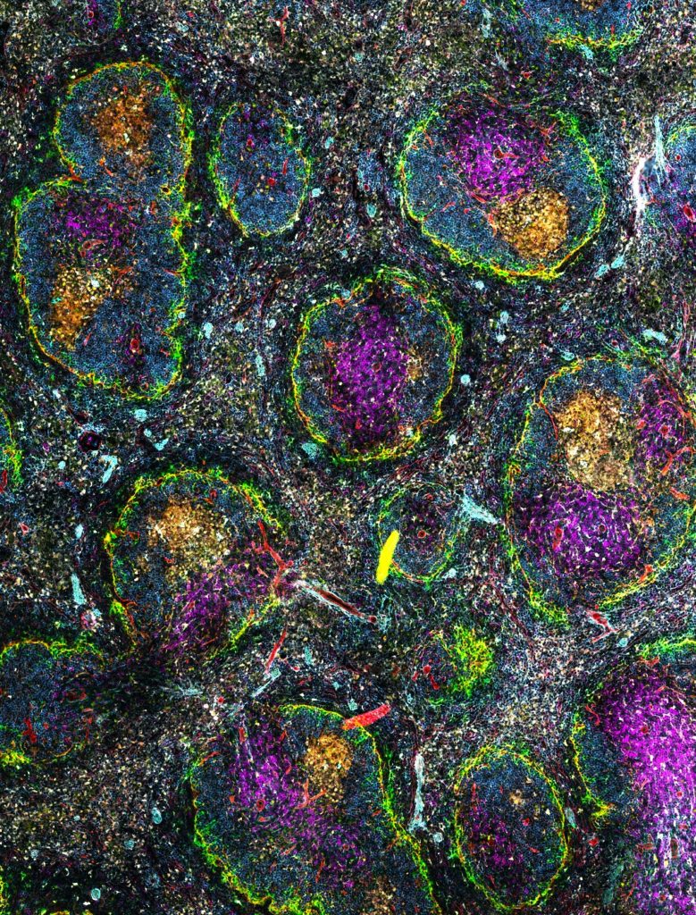 Spatial proteomics