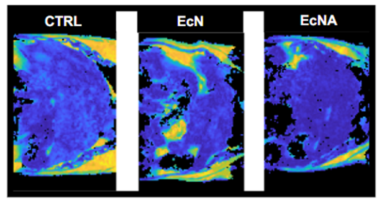 Representative MRI images of livers.